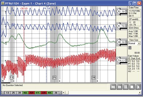 ventura polygraph screen